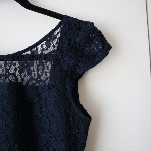 Hollister Navy Blue Lace Mini Dress - Picture 5 of 8